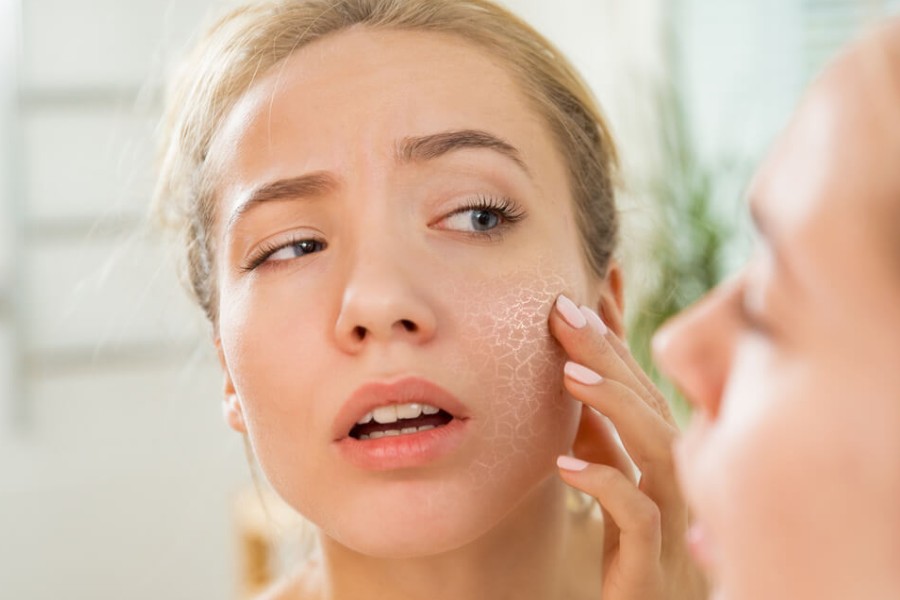 DETOX DA MẶT LÀ GÌ? NHỮNG TRƯỜNG HỢP VÀ DẤU HIỆU NÀO CẦN DETOX DA?