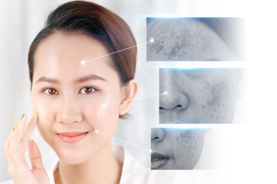 DETOX DA MẶT LÀ GÌ? NHỮNG TRƯỜNG HỢP VÀ DẤU HIỆU NÀO CẦN DETOX DA?