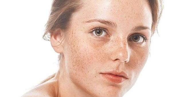 roi-loan-sac-to-da-la-gi-nguyen-nhan-va-cach-dieu-tri-hieu-qua